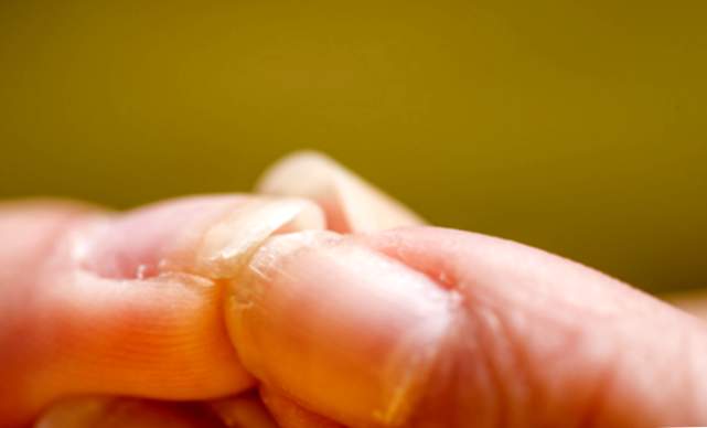 Suggerimenti per prenderti cura delle tue unghie se hai agitato