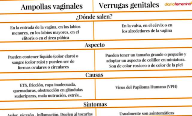 Ampoules vaginales vs verrues génitales. Qu'est-ce qui les différencie?
